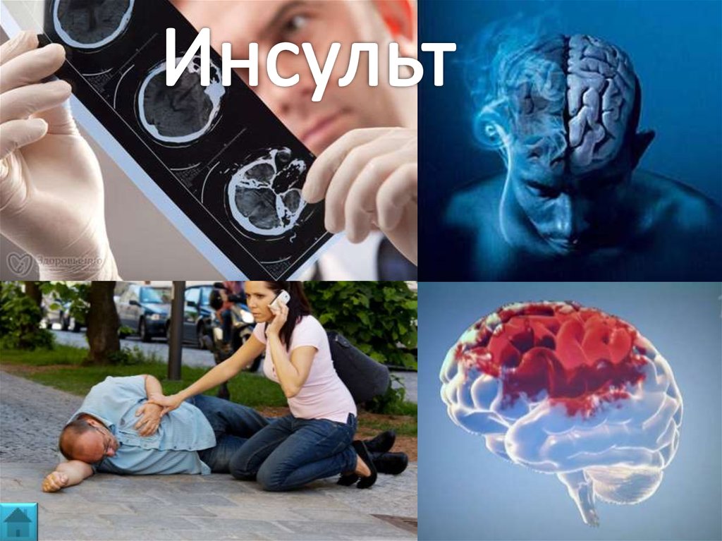 29 октября – Всемирный день борьбы с инсультом. 29 октября – Всемирный день борьбы с инсультом.