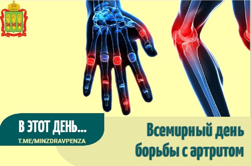 12 октября отмечается Всемирный день борьбы с артритом 12 октября отмечается Всемирный день борьбы с артритом