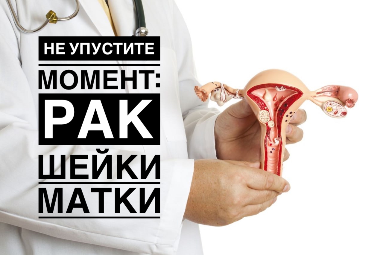Не упустите момент:рак шейки матки. Не упустите момент:рак шейки матки.