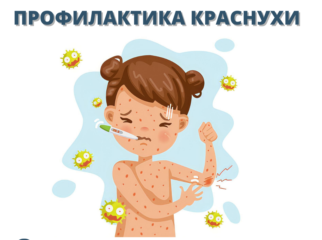 Профилактика краснухи Профилактика краснухи