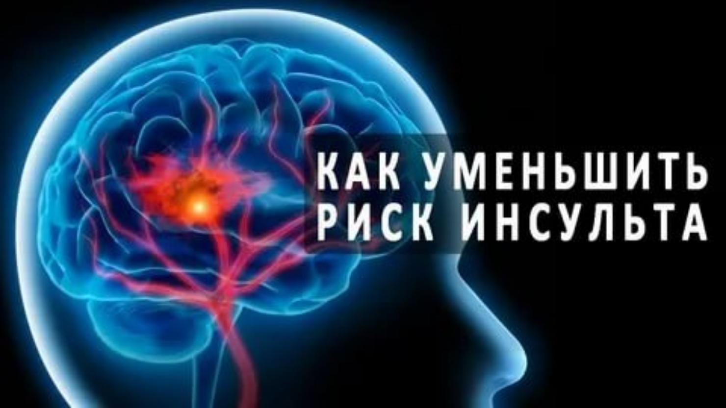   Как снизить риск инсульта?