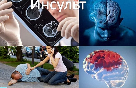 29 октября – Всемирный день борьбы с инсультом.