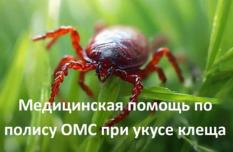 Как получить медицинскую помощь по ОМС при укусе клеща