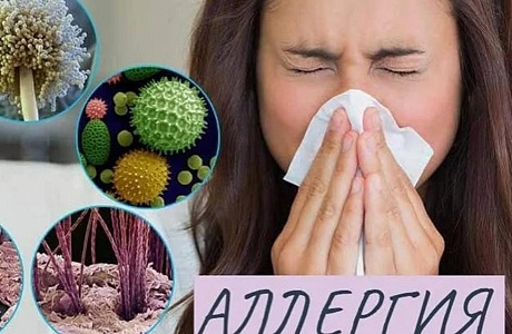 Помощь при аллергии