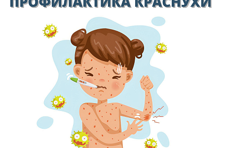 Профилактика краснухи Профилактика краснухи